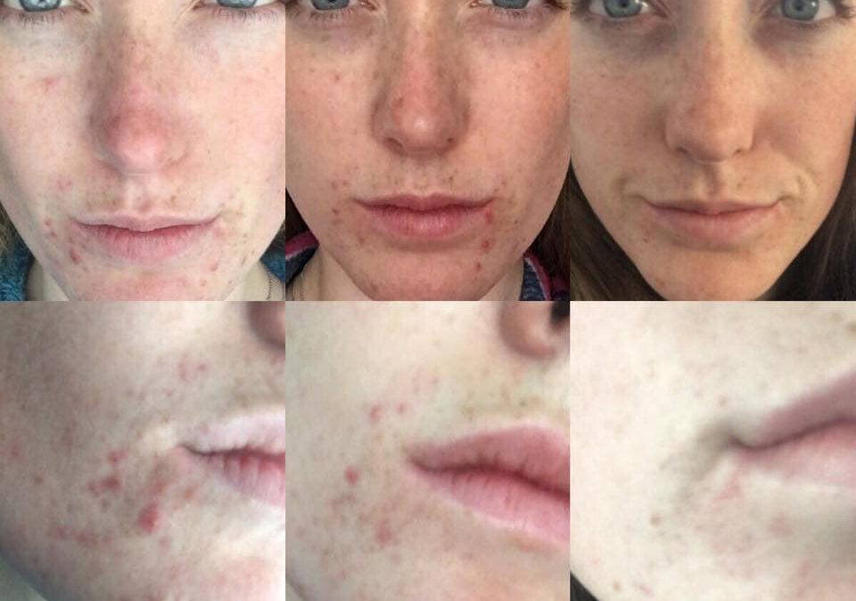 Healthy Skin, Healthy Eating & Healthy Ageing Consultations